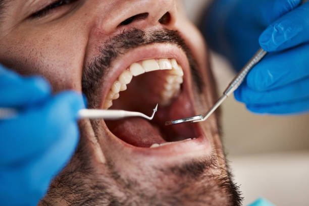 Best Emergency Treatment for Toothache in Victoria, MS