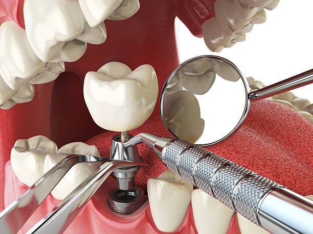 Best Pediatric Emergency Dentist in Victoria, MS